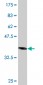 AHCYL1 Antibody (monoclonal) (M03)
